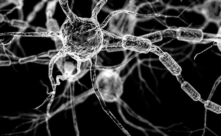 alzheimer's disease and sleep - image of brain neurons